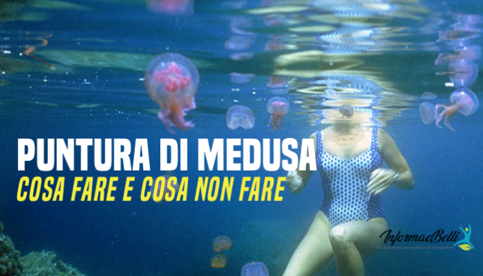 puntura di medusa