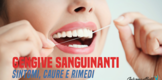 gengive sanguinanti