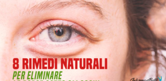 borse sotto gli occhi rimedi naturali