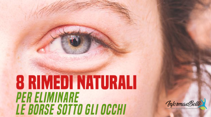 borse sotto gli occhi rimedi naturali