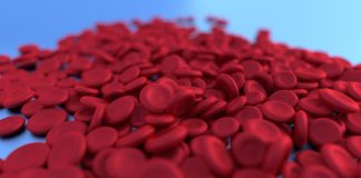 Anemia da carenza di ferro